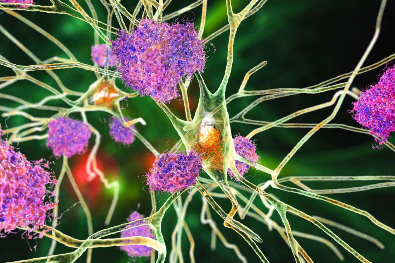 Low dose of lithium reverses Alzheimer’s symptoms in mice