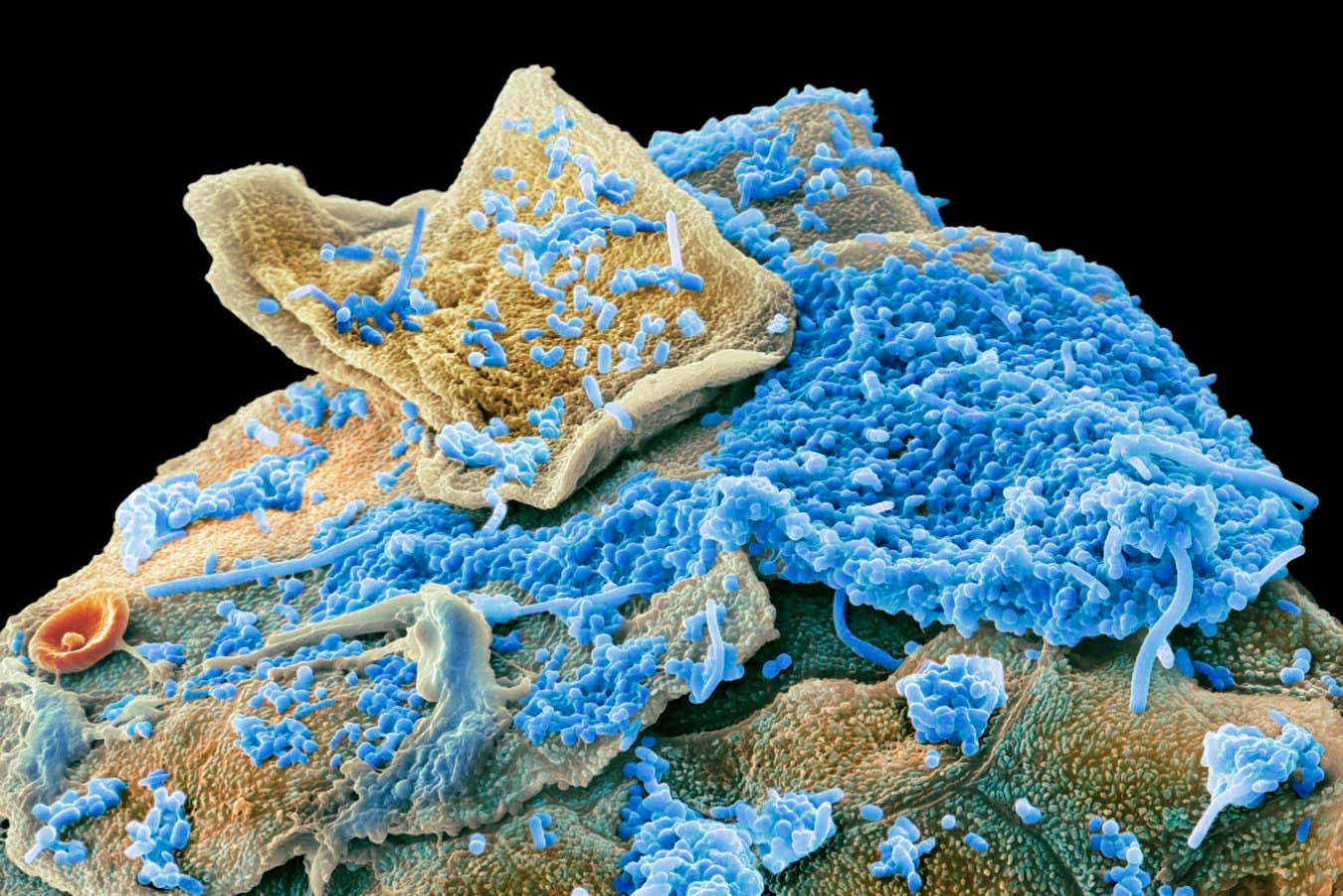 Our oral microbiome could hold the key to preventing obesity