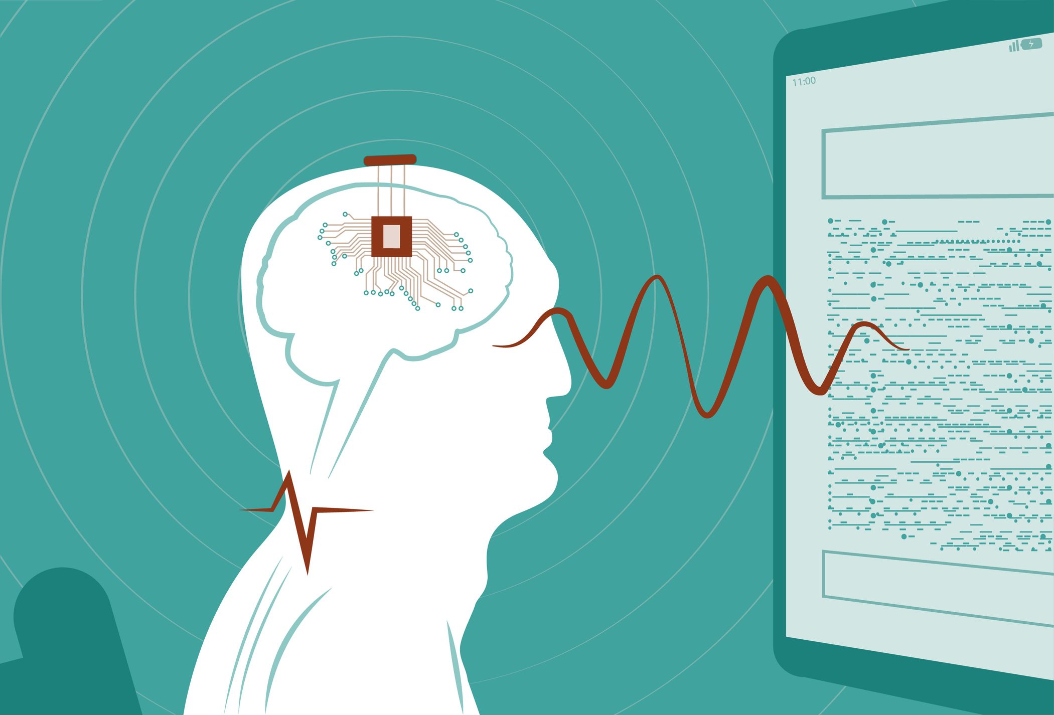 China Approves the First Brain Chips for Sale—and Has a Plan to Dominate the Industry