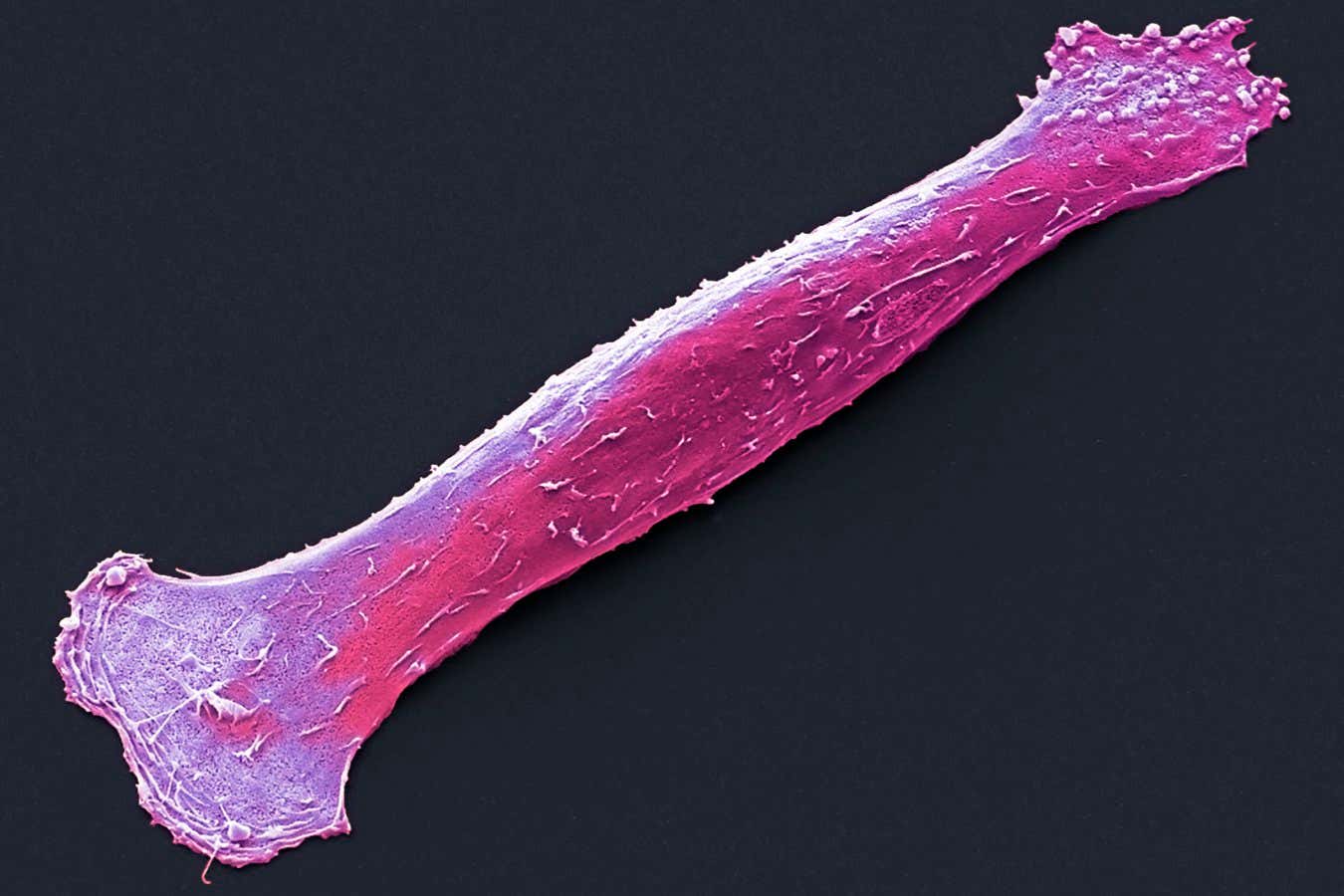 Rebooting stem cells builds aged muscles and assists injury recovery